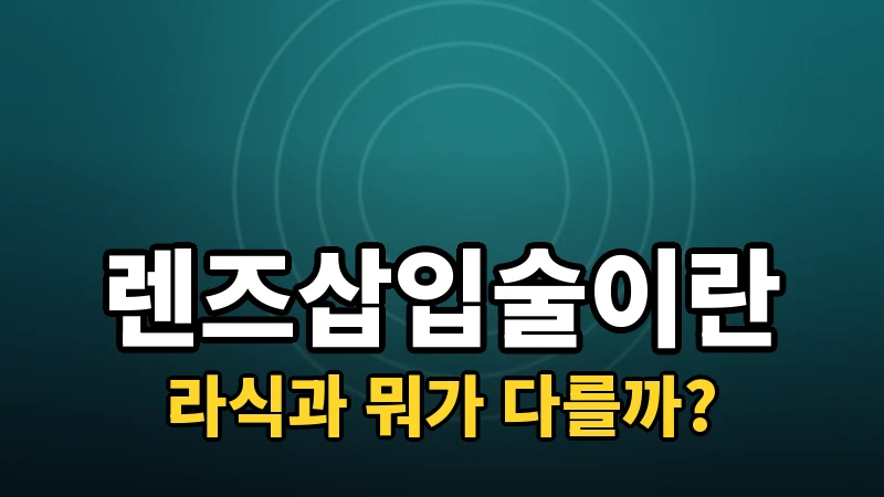 렌즈삽입술(ICL)이란? 원리와 대상 정리
